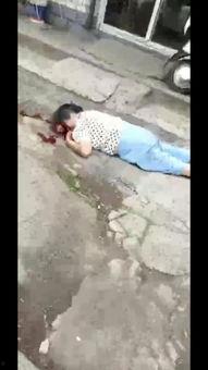 爆料者受伤视频 第2张 爆料者受伤视频 第2张